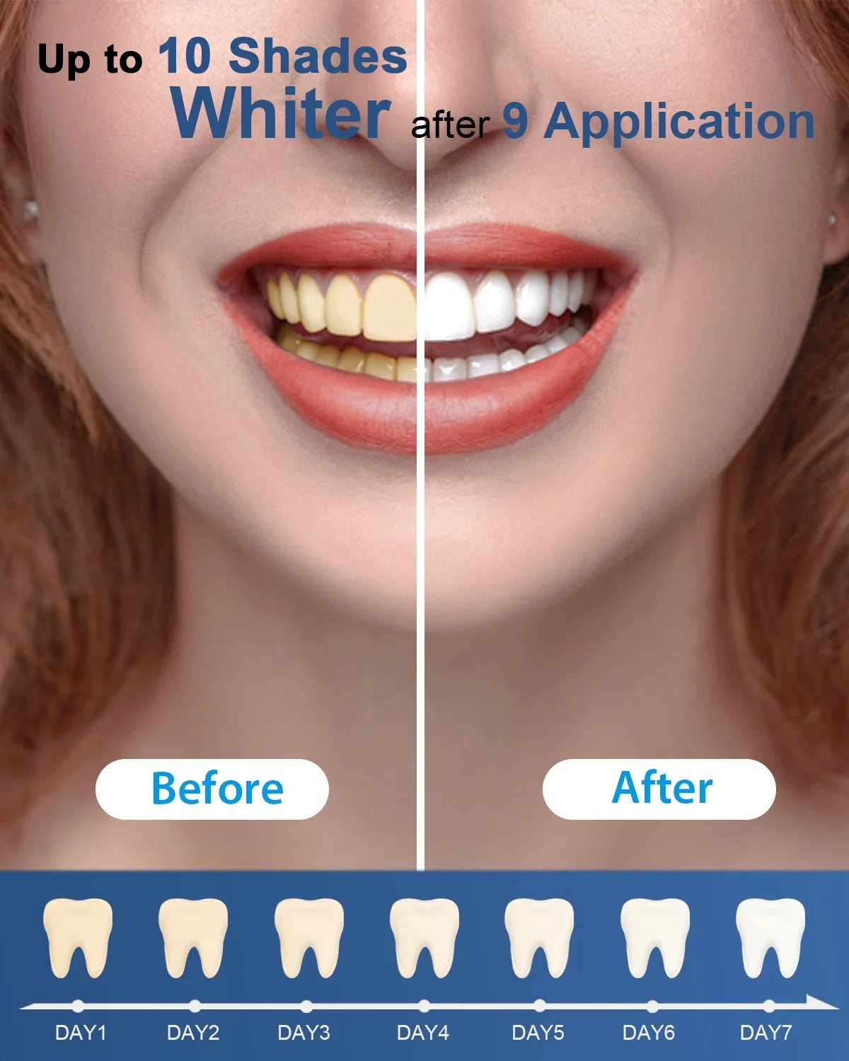 Teeth Whitening Kit with 5-LED Light, Non-Sensitive Teeth Whitening Gel,10 Min Remove Stains